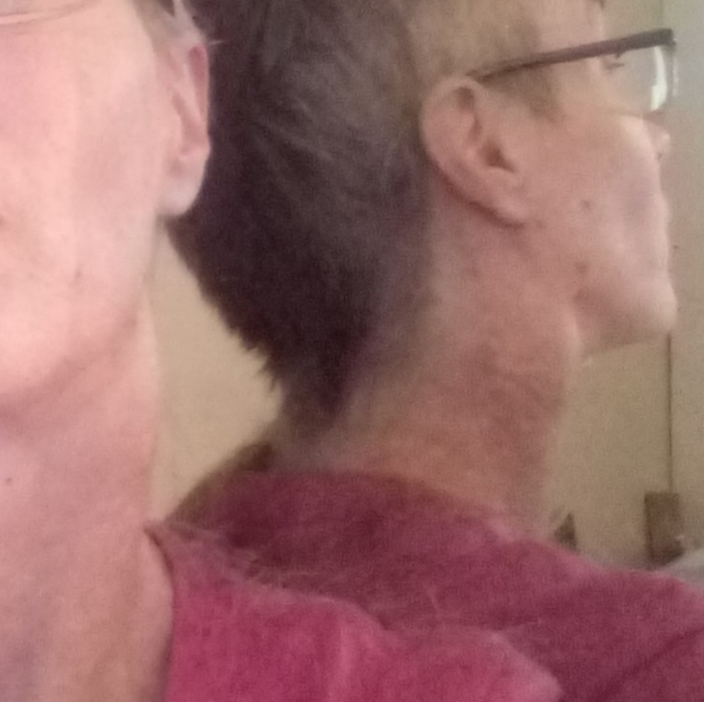 My Cancer Update - Picture 5 of 16